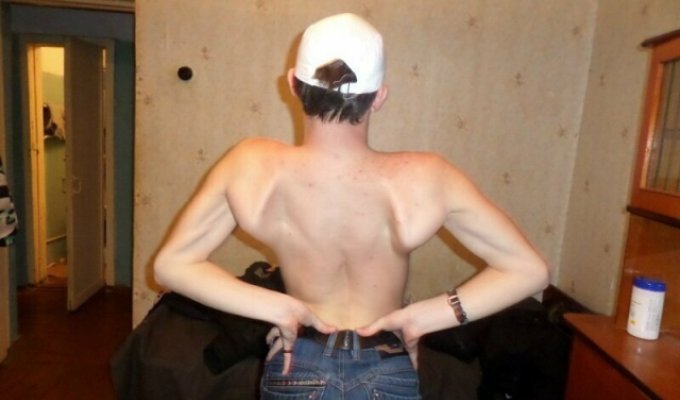 Синдром широкой спины или "жертвы качалки" (19 фото)