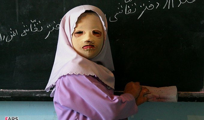 Школа для прокаженных в Иране (3 фото)