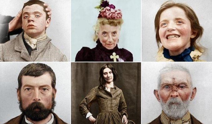 Пациенты психушек викторианской эпохи: истории в фотографиях (17 фото)