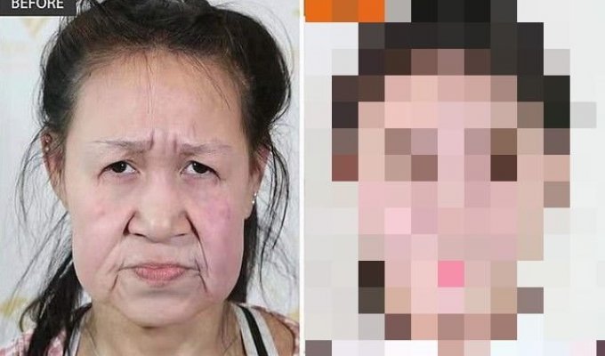 15-летнюю китаянку путали с бабушкой, но после операции она стала красавицей (8 фото)