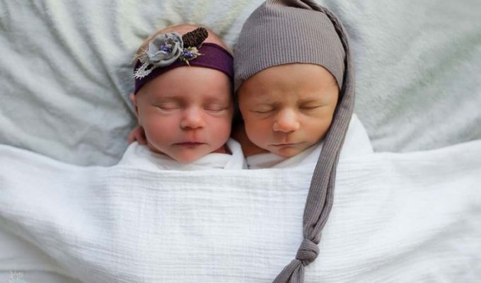 Родители новорожденных близнецов решили устроить фотосессию, зная что один из них скоро должен умереть (10 фото)