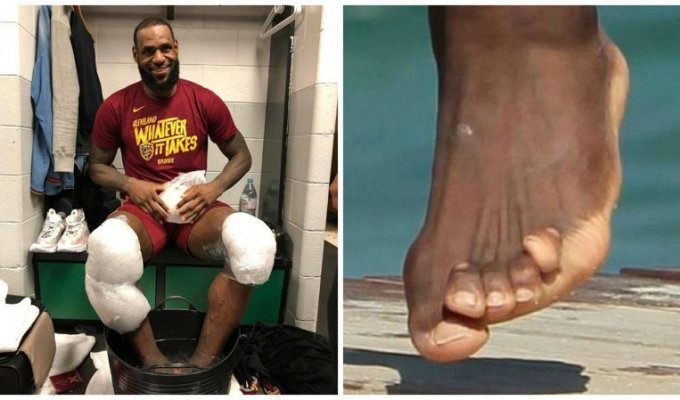 Баскетбол требует жертв: "лотусовые ножки" игроков НБА (10 фото)