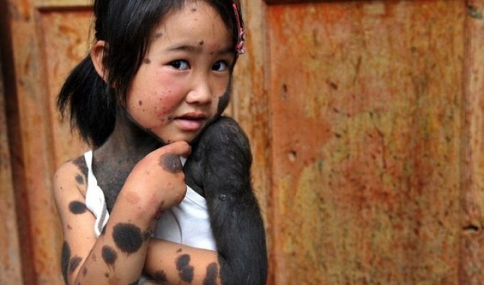 Девочка-мутант из Китая (4 фото)
