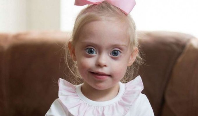2-летняя девочка с синдромом Дауна стала моделью благодаря своей дерзкой улыбке (12 фото)