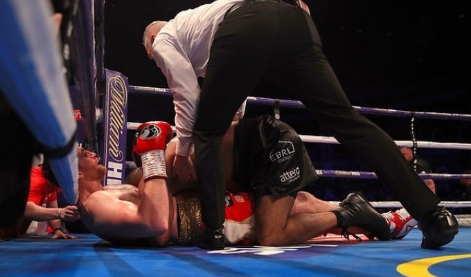 Британский боксер Кэш Али укусил Дэвида Прайса во время боя (6 фото + видео)
