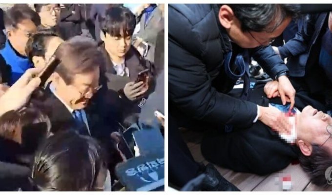 В Южной Корее лидера оппозиционной партии ударили ножом в шею (2 фото + 1 видео)