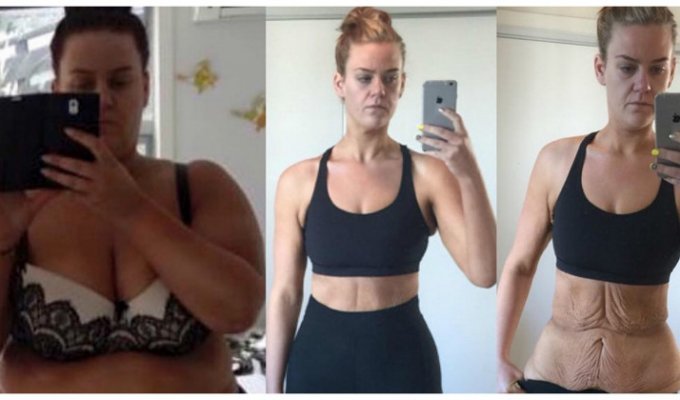25-летняя девушка, похудевшая на 92 кг, показала результаты борьбы с обвисшей кожей (16 фото)