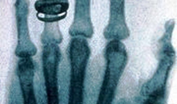 5 одних из самых интересных рентгеновских снимков за всю историю (7 фото)