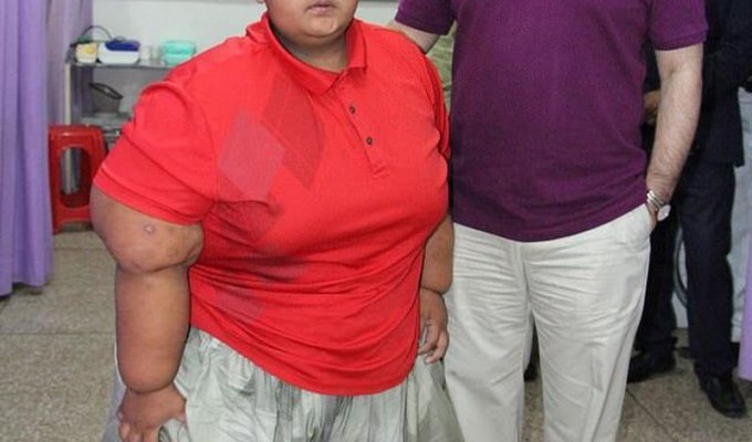 10-летний пакистанец весит почти 200 килограммов (3 фото)