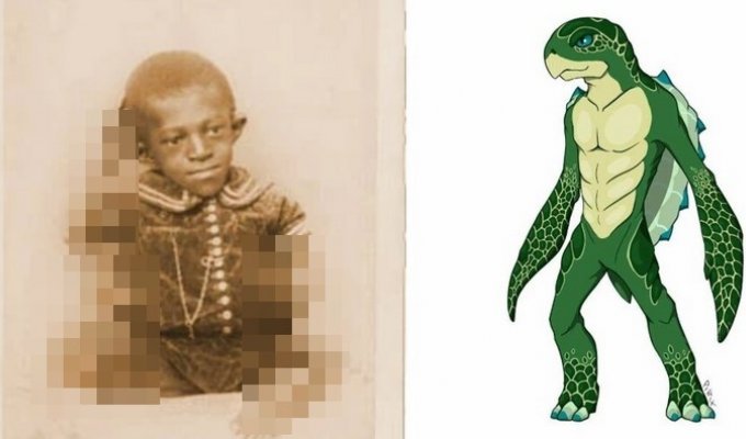 Джордж Уильямс – мальчик-черепаха и его история (5 фото)