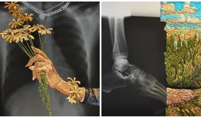 Рентгеновская пленка и вышивка: необычные картины Мэтью Кокса (26 фото)