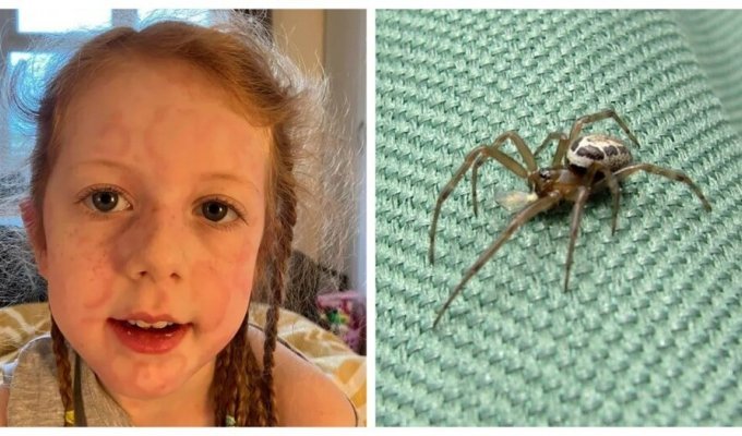 Самый опасный паук Великобритании укусил 5-летнюю девочку (6 фото)