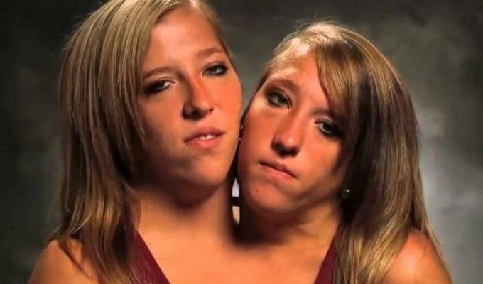 15 интересных фактов о сиамских близняшках Хенсел (16 фото)
