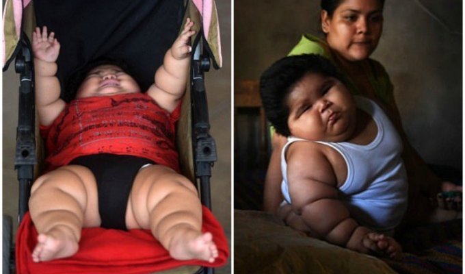 10-месячный мальчик из Мексики весом 28 кг — самый толстый ребёнок в мире (9 фото)