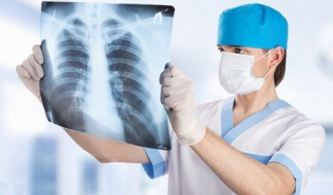 Не разглядели: врачи в течение шести лет не видели рак лёгких на снимках флюорографии (2 фото)