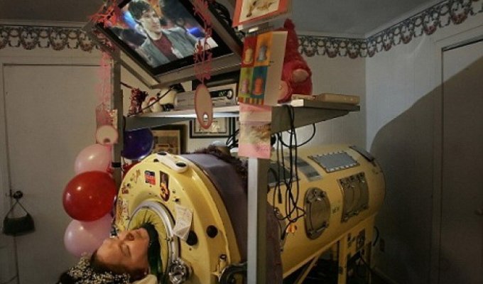 Жизнь в «танке»: женщина провела почти 60 лет в аппарате вентиляции легких (8 фото)