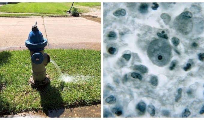 В техасском водопроводе обнаружили амебу, пожирающую мозг (5 фото)