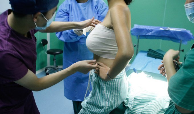 «Пластика Золушки»: японцы практикуют увеличение груди на сутки (8 фото)