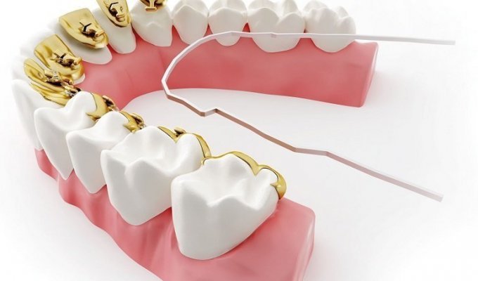 Странный стоматолог (1 фото)