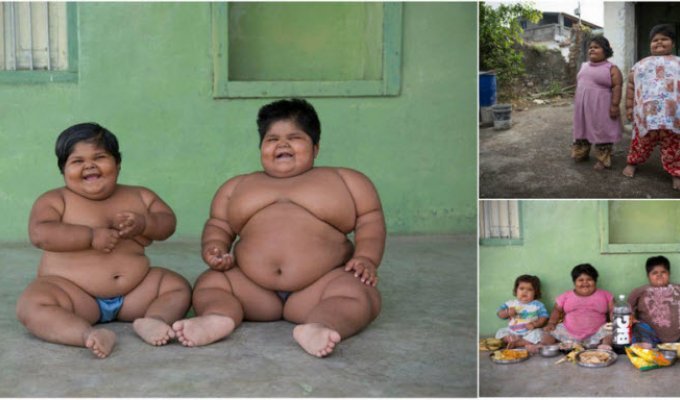 Самым толстым сестрам из Индии уменьшили желудки и они начали худеть (12 фото)