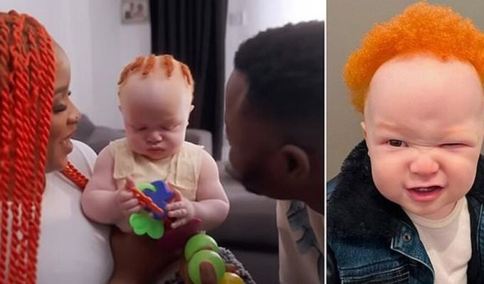 У чернокожих родителей получился ребёнок-альбинос с рыжими волосами (6 фото + 1 видео)