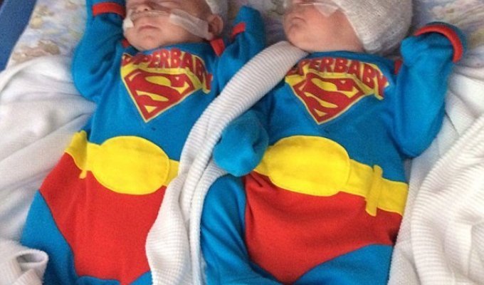 "Это чудо": близнецы родились на сроке 25 недель и выжили (7 фото + 1 видео)