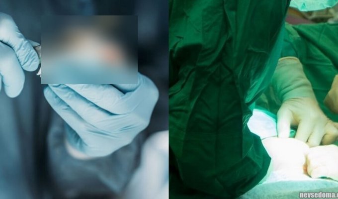 Хирурги из Сочи забыли в теле пациентки скальпель, который обнаружили через несколько месяцев (2 фото)