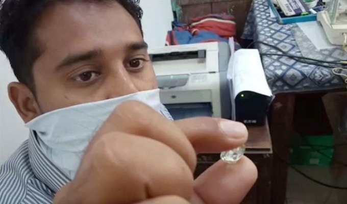 Миллионер из трущоб: шахтер из Индии нашел огромный алмаз и разбогател (3 фото)