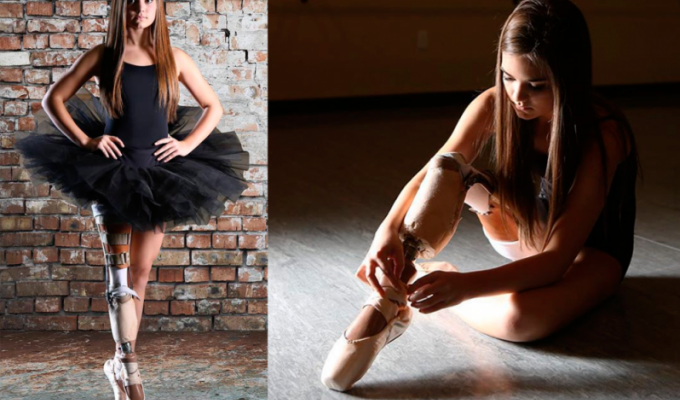 Даже с ампутированной ногой она выполнила свою мечту и стала балериной! (15 фото)