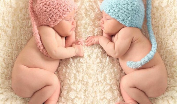 В Австралии родились редчайшие полуидентичные близнецы (4 фото)