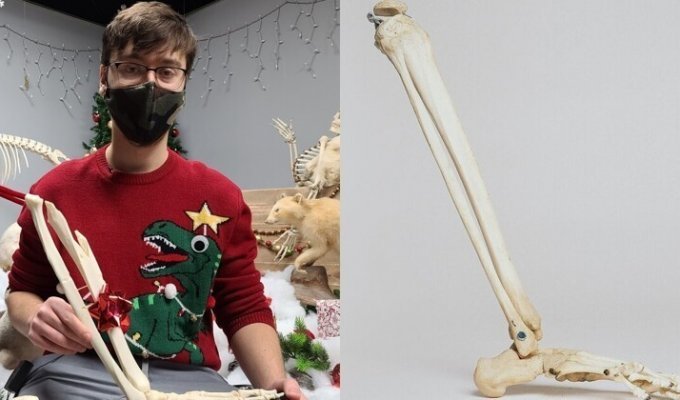 Какой год - такие и подарки: канадец заказал к Рождеству сувенир из своей ампутированной ноги (5 фото)