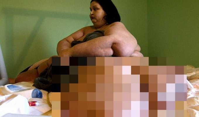 Самой тяжелой женщине в мире удалось похудеть (7 фото)
