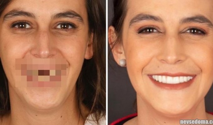"Сила красивой улыбки": работы португальского дантиста, который преображает своих пациентов (15 фото)