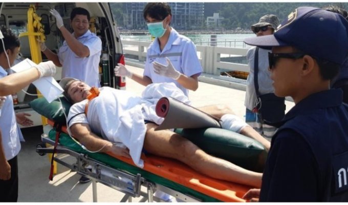 Отдыхавший в Таиланде россиянин случайно прострелил себе ногу гарпуном (3 фото)