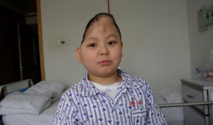 Хо Гочжу - мальчик с половиной головы (6 фото)