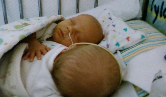 Настоящее чудо: фотографии малышей, родившихся раньше срока, но сумевших выжить (50 фото)