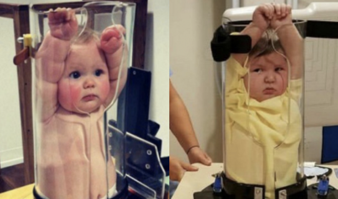 Рентген для младенца: смешно или страшно? (10 фото)