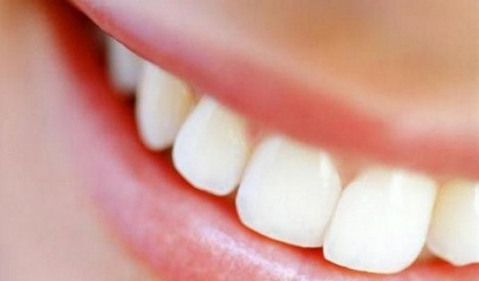 Интересные факты о зубах (9 фото)