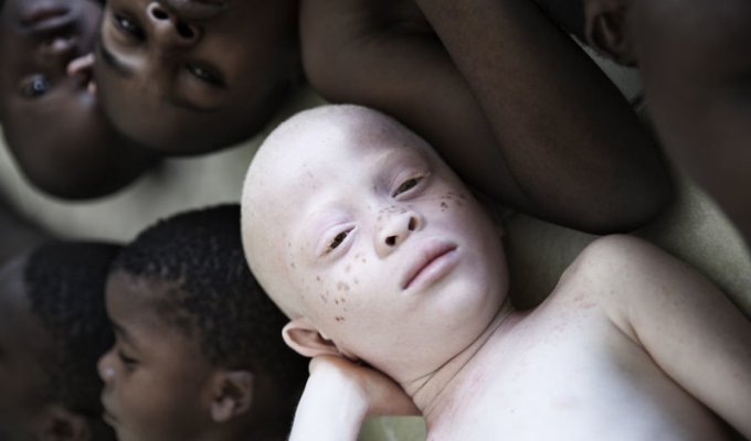 Удивительные портреты альбиносов Танзании, призывающие мир "проснуться" (12 фото)