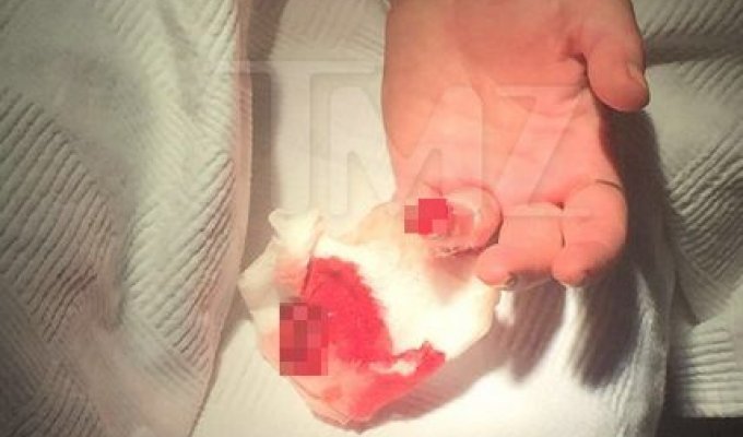 Линдси Лохан лишалась части безымянного пальца левой руки (2 фото)