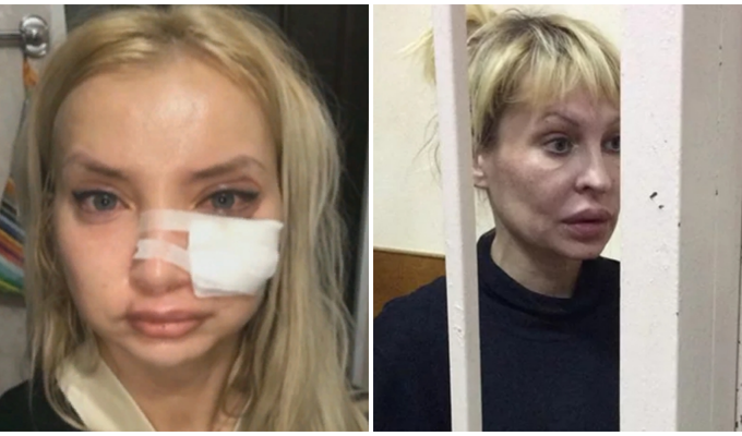 Горе-косметолог изуродовала почти два десятка человек и села в тюрьму (4 фото)