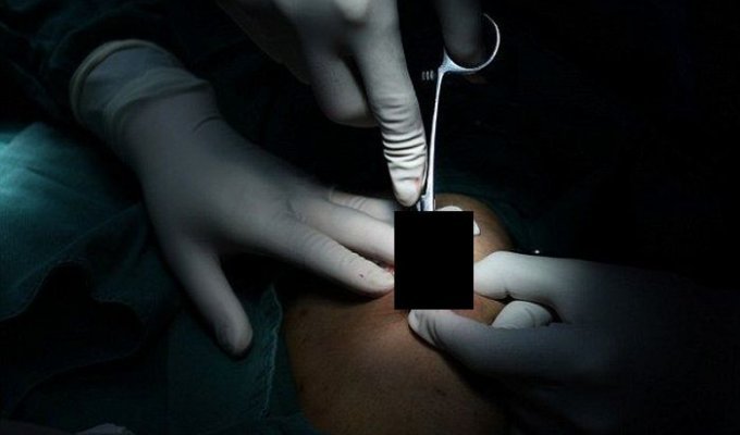 Нетрадиционное лечение от китайского лекаря (5 фото)