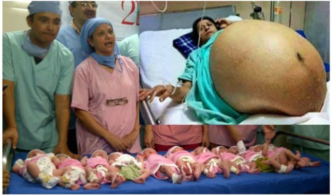 Жительница Индии в возрасте 42-х лет родила 11 детей (12 фото)