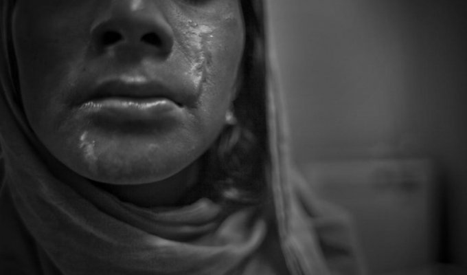Воспитание кислотой в Бангладеш (15 фото)