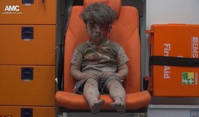 Эти снимки раненого пятилетнего сирийца потрясли мир! (17 фото)