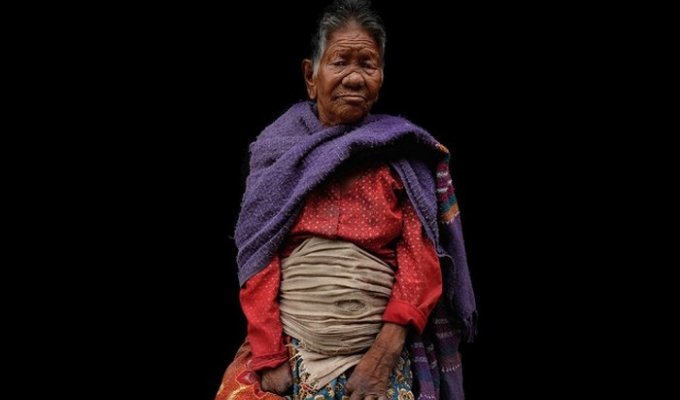 Обитатели колонии прокаженных в Непале (24 фото)