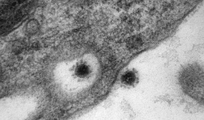 Центр «Вектор» впервые опубликовали снимок смертельного вируса (2 фото)