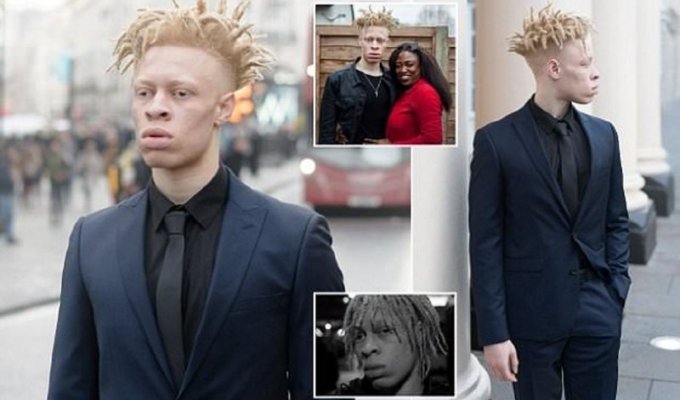 Модель-альбинос ответил тем, кто его травил, снявшись для Vogue (15 фото)