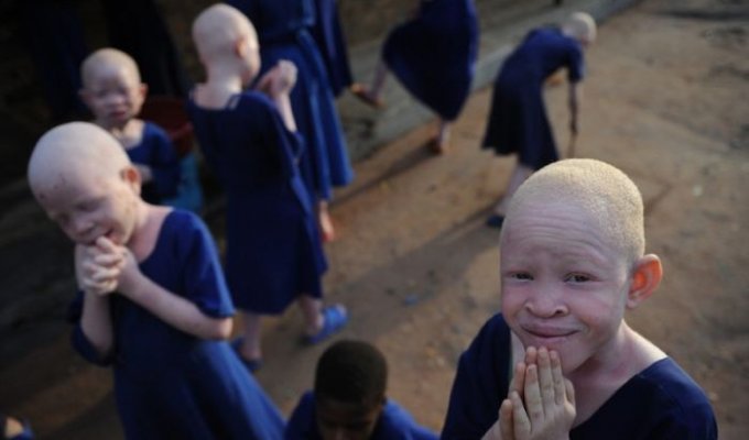 Африканские альбиносы (8 фото)