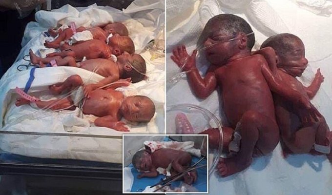 Жительница Ирака родила семерню (5 фото)